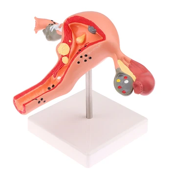 1шт Медицинский реквизит Модель патологической матки Анатомическая модель яичника Инструмент для изучения анатомического сечения